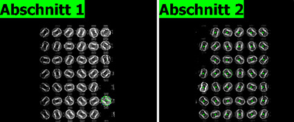 Evaluation of the 3D image for the removal of the individual pistons